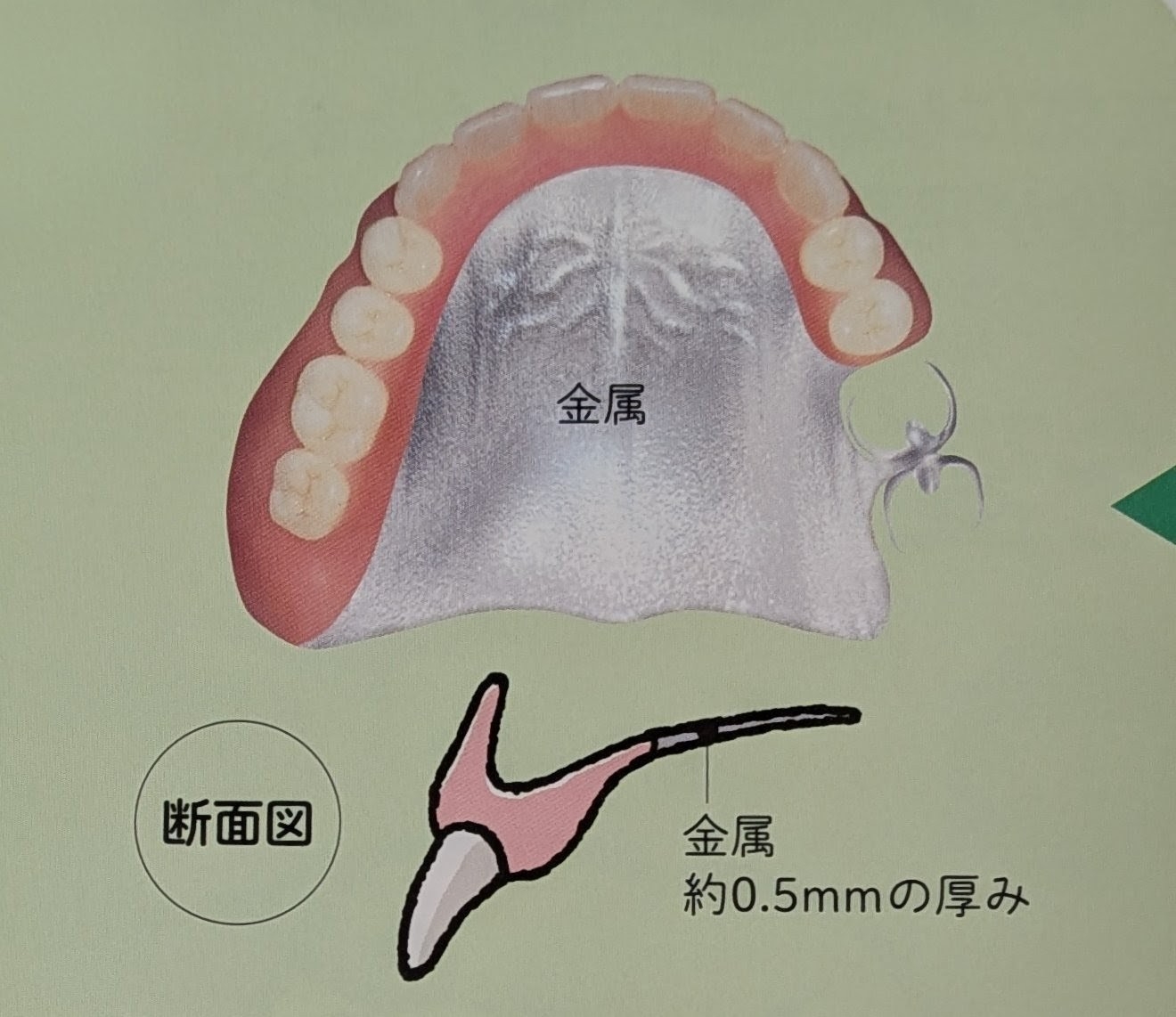 金属