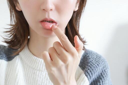 口内炎の原因と対策についての掲載画像