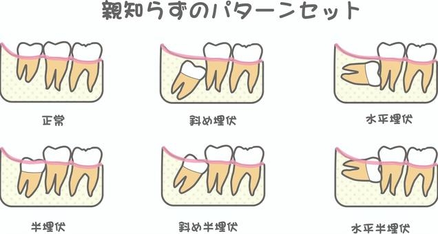 親知らずについての掲載画像