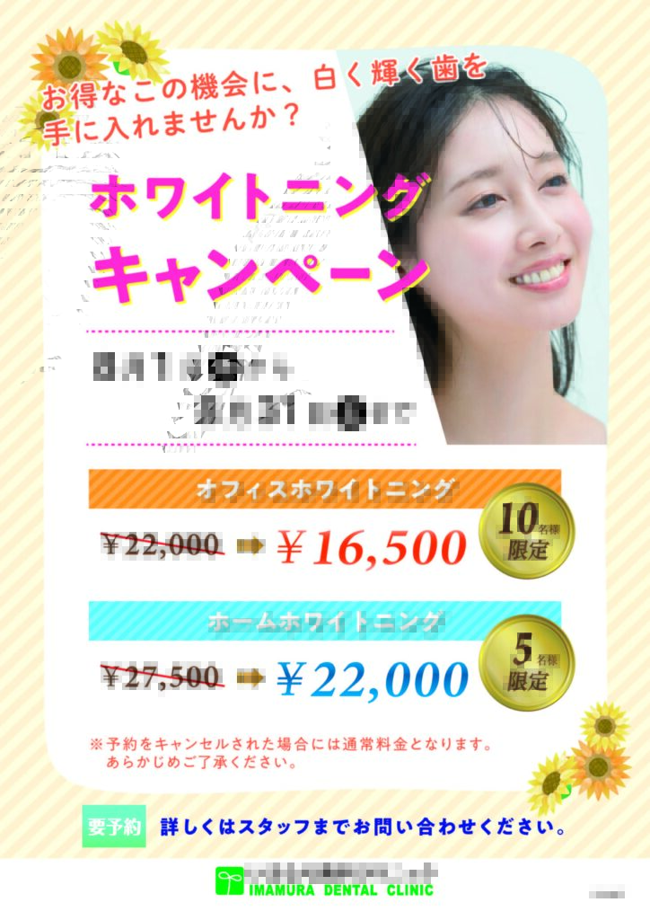♪ホワイトニングキャンペーン♪の掲載画像